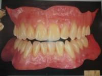 Caldwell Denture Service
