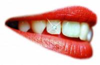 Smilegems Australia