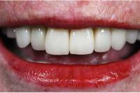 ProSmiles Dental Clinic