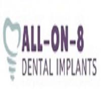 All On 8 Dental Implants