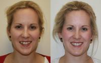 Cosmetic & Laser Dentistry Centre