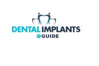 Dental Implants Guide