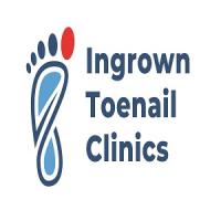 Ingrown Toenail Clinics