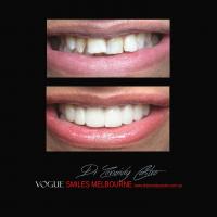 Vogue Smiles Melbourne