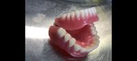 Mobile Denture Melbourne