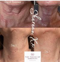 The Touch of Serenity