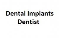 Dental Implants Dentist