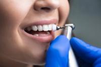 Teeth whitening Townsville