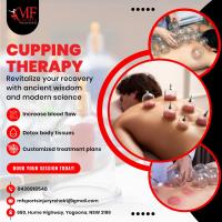 Cupping Therapy