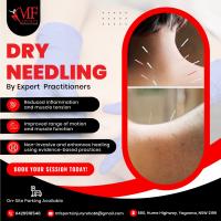 Dry Needling