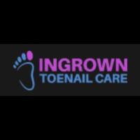 Ingrown Toenail Care